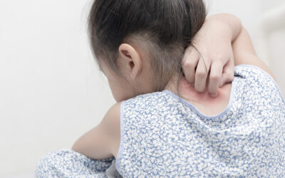 ¿Qué es la dermatitis infantil y cómo tratarla?
