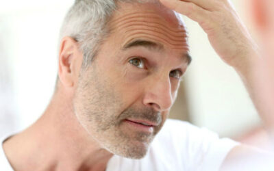 Diferencias entre la calvicie y la alopecia